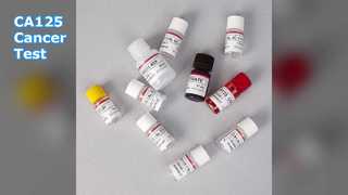 Kanser İzleme için CA125 ELISA Testi