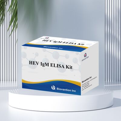 Yüksek Duyarlılıklı HEV IgM Elisa Test Kits 96T Boyutlu ve 2-3 Saatlik Doğruluğu Sağlayan Test Zamanı