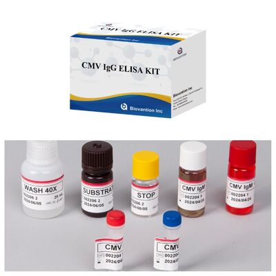 96T CMV ELISA Test Kiti, Renkölçer Algılama ve Sandviç Yöntemi ile Sitomegalovirüs Antikorları İçin
