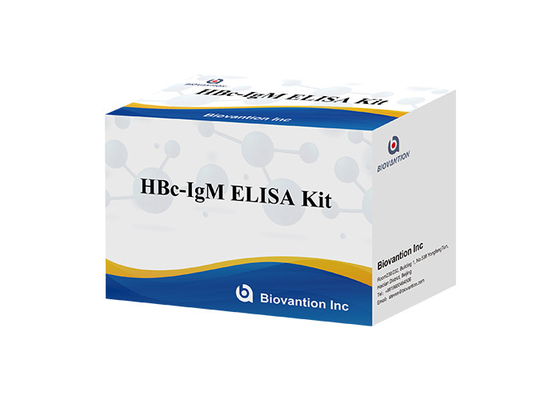 ISO13485 HBc IgM Test Kiti Hepatit B Core Antikor Igm Testi
