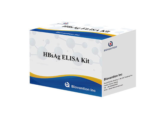 Enfeksiyon Hastalıkları HBsAg Elisa Kiti Hepatit B Yüzey Antijen Elisa Testi