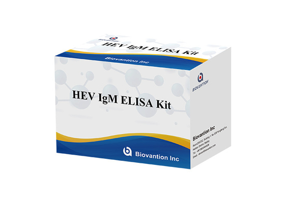 Antikor Tespiti için HEV IgM Elisa Test Kiti Serum Vs Plazma