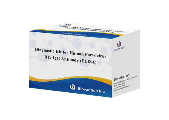 İnsan Parvovirus B19 IgG elisa testi için teşhis kiti Serum numuneleri için antikor