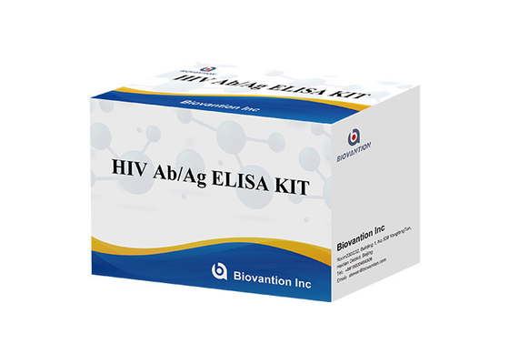 ISO13485 HIV Ab Ag Testi Hiv 4. Nesil Test ELISA Kiti 60 Dakika