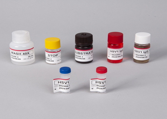 Alfa Fetoprotein Test Elisa Nitelik Depo Lab veya Hastane Kullanımı