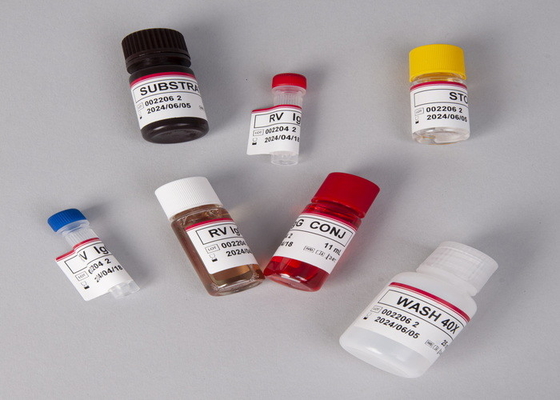 Alfa Fetoprotein AFP Elisa Laboratuvar veya Hastane Test Kits