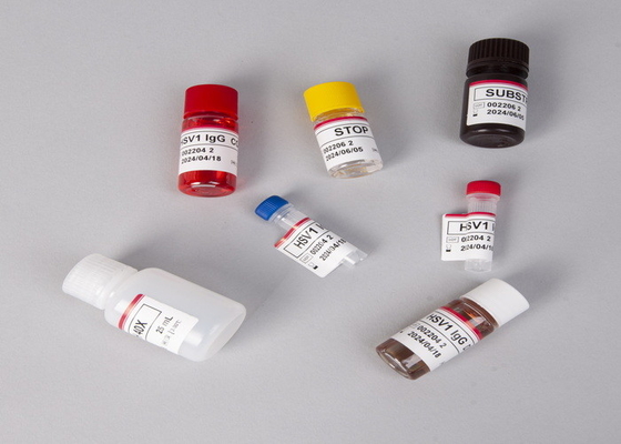 Laboratuvar veya hastane için yüksek hassasiyetli CA15-3 Elisa Test Kits