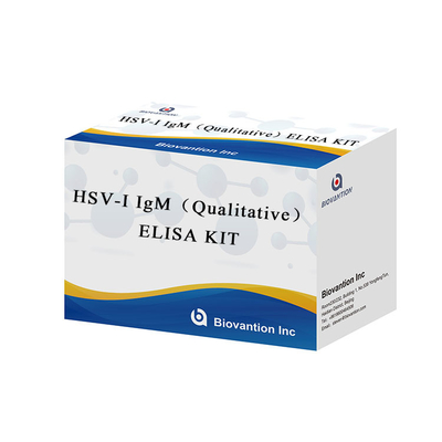 Laboratuvar veya Hastane HSV I IgG ELISA Test KİTİ'nin Kullanımı için Yüksek Hassasiyetli Talimatlar