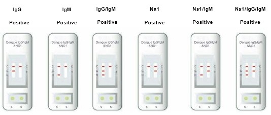 Hastane, Tıp Merkezi, Kendisi Yüksek Kesinlikle Bir Adımlı Dengü IgG & IgM Test Kiti