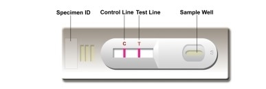 Laboratuvar veya Hastane Kendi Test Yüksek Doğruluklı Leishmania Ab Kombo Hızlı Test