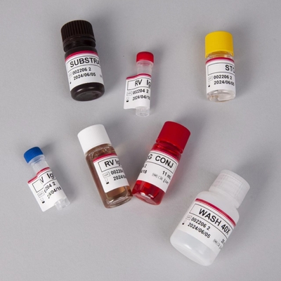 Plasma örneği türü teşhisi için RV-G Elisa Test Kits