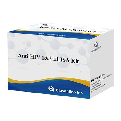 HIV Elisa Test Kits 18 Aylık Geçerlilik Elisa Test Yüksek Duyarlılık ve Spesifikite