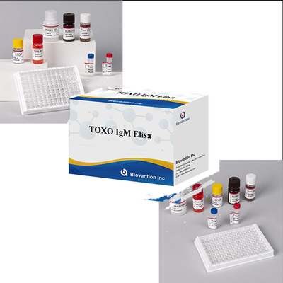 Hastaneler laboratuvarlar klinikler yüksek doğruluklu Toxo IgM ELISA test kitleri kullanır