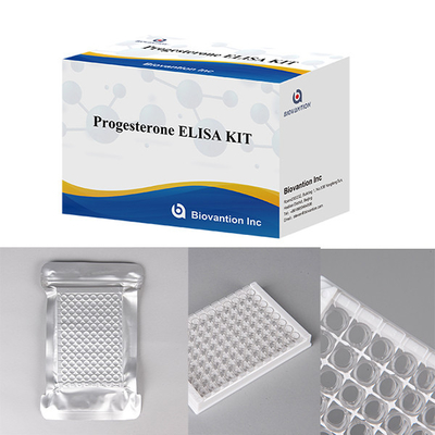 Hastaneler Laboratuvarlar Klinikler Progesteron Kullanmak Mide Immunoassay ELISA TEST KIT