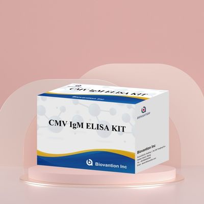 Laboratuvar veya Hastane Yüksek Doğruluklı CMV IgG Elisa Test Kits