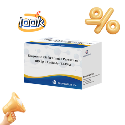 İnsan Parvovirus B19 IgM Antibody Elisa Test Kit 96T ile