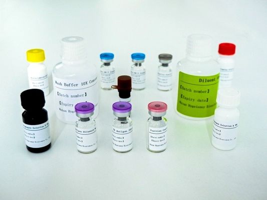 Serum Plazma TB-IGRA