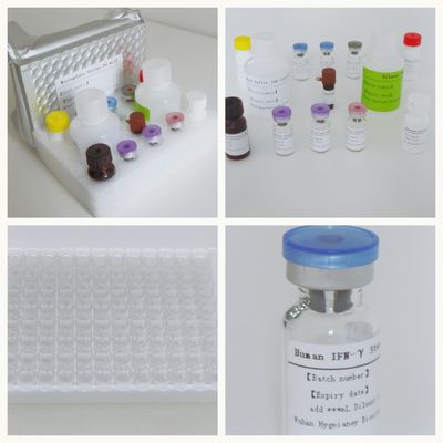 Serum Plazma TB-IGRA