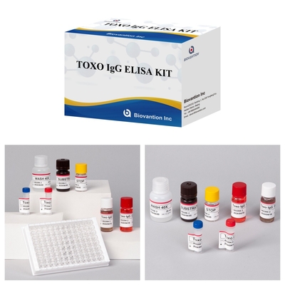 TOXO Ig G Hastalık İzleme için Duyarlı ve Spesifik Elisa Test Seti