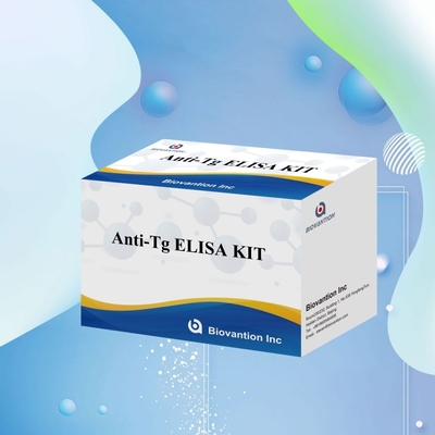 Elisa İnsan Antitirooglobulin Antibody Anti-Tg Hastane ve Laboratuvar için Diagnostic Kit