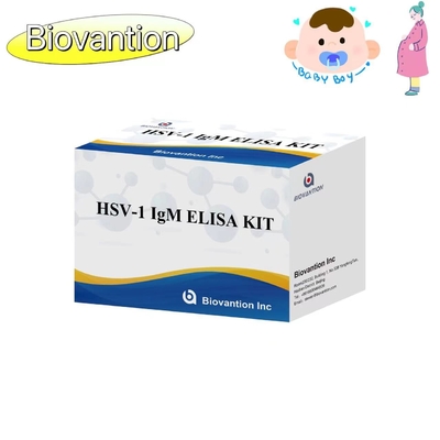 Torch ELISA Test Kit HSV 1 IgM Yüksek Sıcak Satış Tanı Reagent IVD