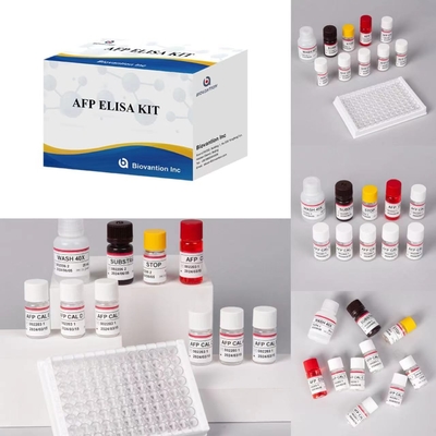 AFP Alfa Fetoprotein Elisa Test Kits Enzim Bağlı Ürünler Ulaşım Zamanı Kısa