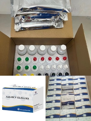 Hepatit C Virüsüne Karşı Anti-HCV Antikorları Enzim Bağlı Taşıma Zamanı Kısa