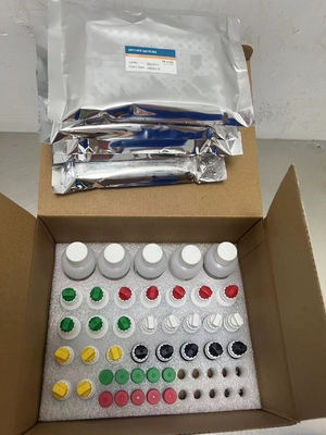 Hepatit C Virüsüne Karşı Anti-HCV Antikorları Enzim Bağlı Taşıma Zamanı Kısa