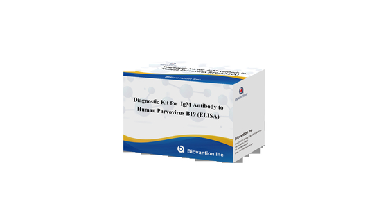 İnsan Parvovirus B19 IgG elisa testi için teşhis kiti Serum numuneleri için antikor