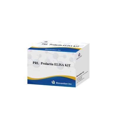 PRL Kvantitatif İnsan Hormonları Tanısal Detektör Reagent Kit
