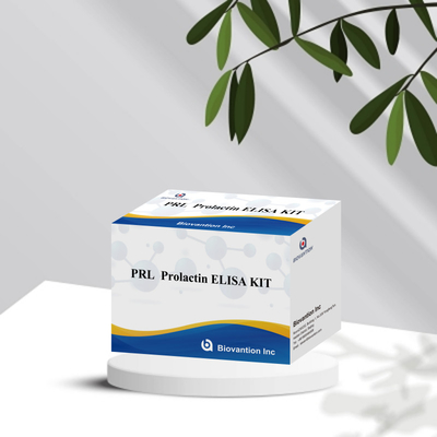 PRL Kvantitatif İnsan Hormonları Tanısal Detektör Reagent Kit