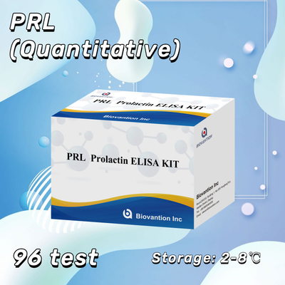 PRL Kvantitatif İnsan Hormonları Tanısal Detektör Reagent Kit