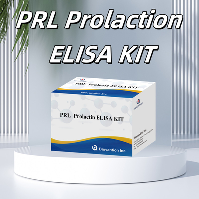 PRL Kvantitatif İnsan Hormonları Tanısal Detektör Reagent Kit
