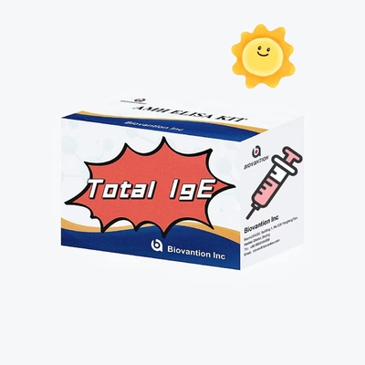 Toplam IgE Elisa Test Kütesi Immunoglobulin E Antidjen Antibody Bağlantısı