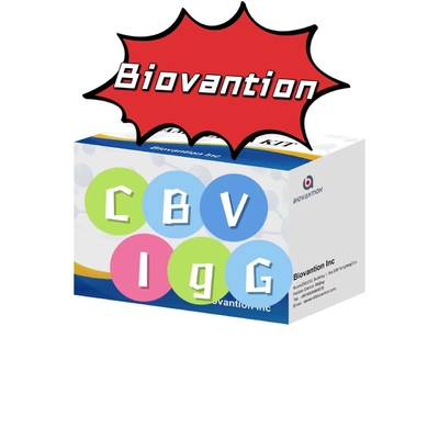 CBV-IgG Antibody ELISA test kitleri için tanı kitleri serum test kitleri