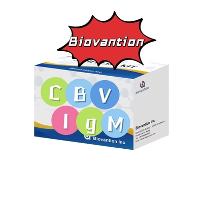 CBV'ye Karşı IgM Antibody Diagnostic Kit Elisa Test Kit 50μL Serum Tıbbi Diagnostik