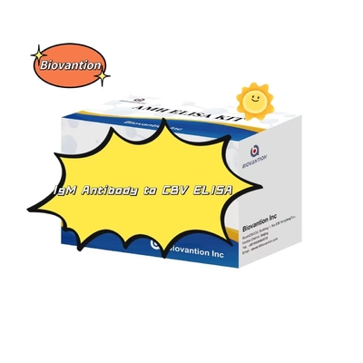 CBV'ye Karşı IgM Antibody Diagnostic Kit Elisa Test Kit 50μL Serum Tıbbi Diagnostik
