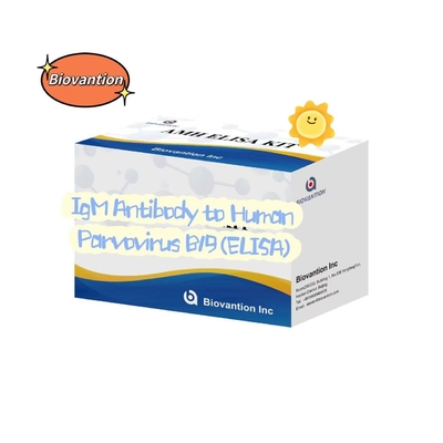 İnsan Parvovirüsüne Karşı Antitemiz B19 IgM ELISA Test Kits Diagnostik Kits