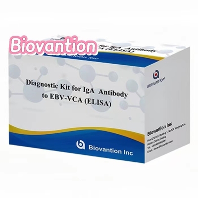 50μl serum numunesi kullanarak tıbbi teşhis için yüksek hassasiyetli EBV VCA IgA ELISA kiti