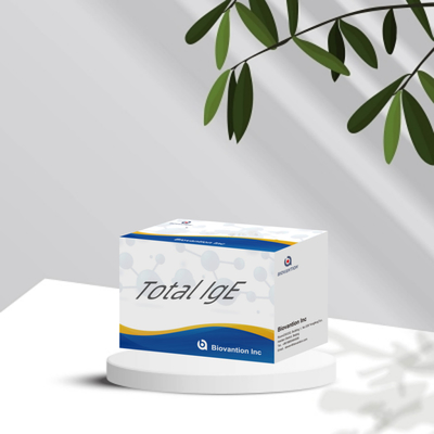 Alerji Toplam IgE Elisa insan algılama rejansi