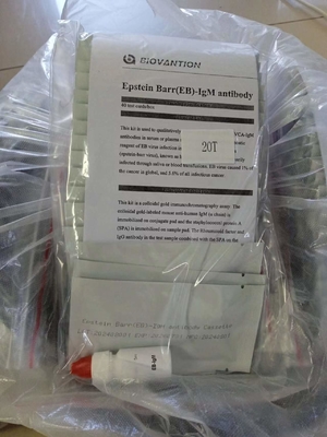 Epstein Barr EB-IgM Antibody Hızlı Test Kaseti Serum Hızlı Testler Profesyonel