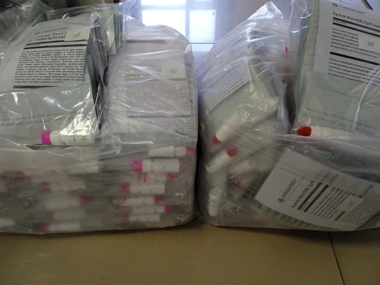 Epstein Barr EB-IgM Antibody Hızlı Test Kaseti Serum Hızlı Testler Profesyonel