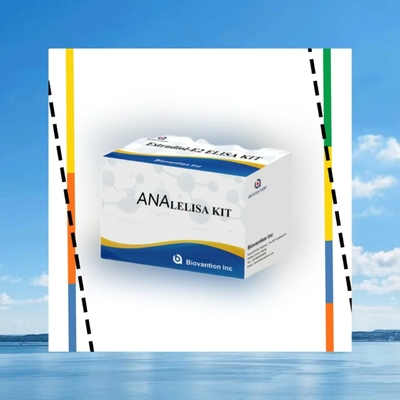 Anti ANA IgG ELISA Test Kits Anti Nükleer IgG Antibedenin Nitelikli Bulunması