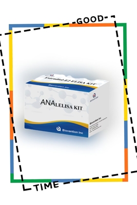 Anti ANA IgG ELISA Test Kits Anti Nükleer IgG Antibedenin Nitelikli Bulunması