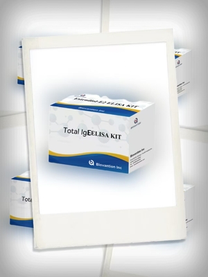 Toplam IgE Antibody ELISA Test Kütesi Serum / Plasma In Vitro Diagnostik