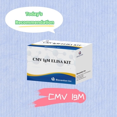 Makrofag IgM kalitatif ELISA testi IVD deneysel kit Yüksek duyarlılık
