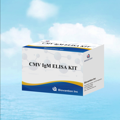 Makrofag IgM kalitatif ELISA testi IVD deneysel kit Yüksek duyarlılık