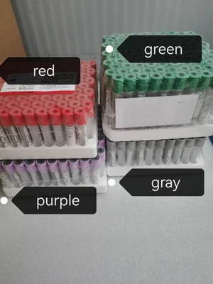 Uzun raf ömrü ve 2C-8C koruma yöntemi ile TB-IGRA ELISA test kitini kullanmak kolaydır.