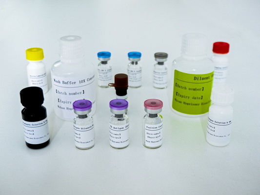 Uzun raf ömrü ve 2C-8C koruma yöntemi ile TB-IGRA ELISA test kitini kullanmak kolaydır.