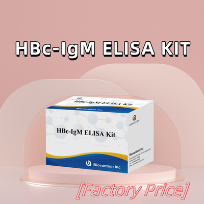 Yüksek hassasiyetli HBc IgM Antjen Reagent Diagnostik Testi Enzim Bağlı Immunosorbant Test Kits ile